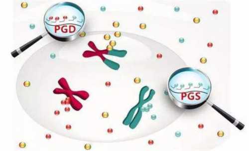 代孕哪里优惠,【试管科普】移植前如何憋尿？