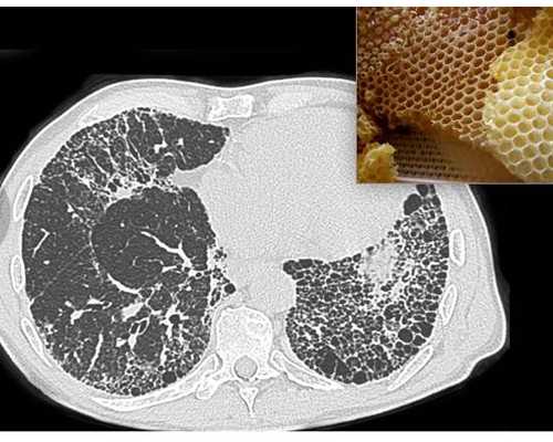 甘肃试管供卵包男孩多少钱,2026太原子宫畸形患者做试管最热门医院排名，附试