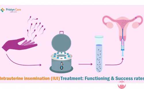 囊胚移植有什么优点呢？