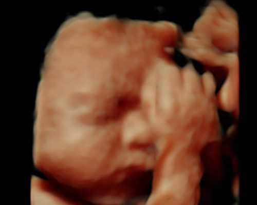 着床成功会浑身酸痛吗