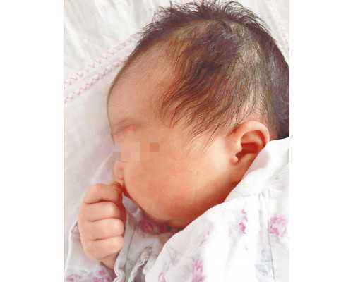 医生建议羊水穿刺不是骗局，出现这些情况必须做