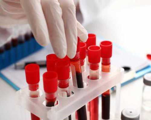 供卵试管代孕中心,做试管应该做什么检查（做试管要做哪些检查）