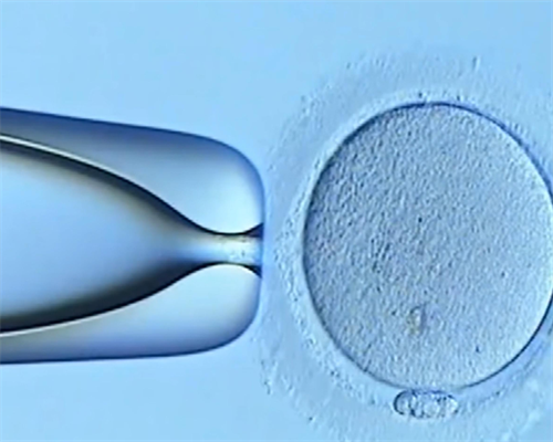 代孕辅助生殖中心在哪里,人工授精可以**性女性么，做人工授精可以生孩子吗