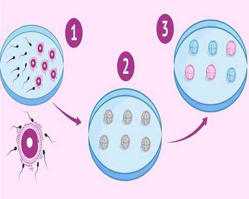 广州做第三代试管婴儿价格？真实价格一览！