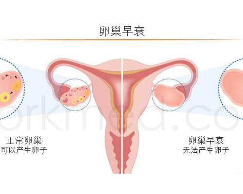 新生儿黄疸保险理赔指南：哪些项目可报销？